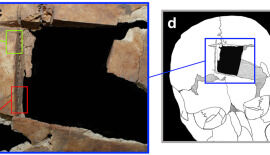Evidence of Late Bronze Age Brain Surgery Found in Megiddo